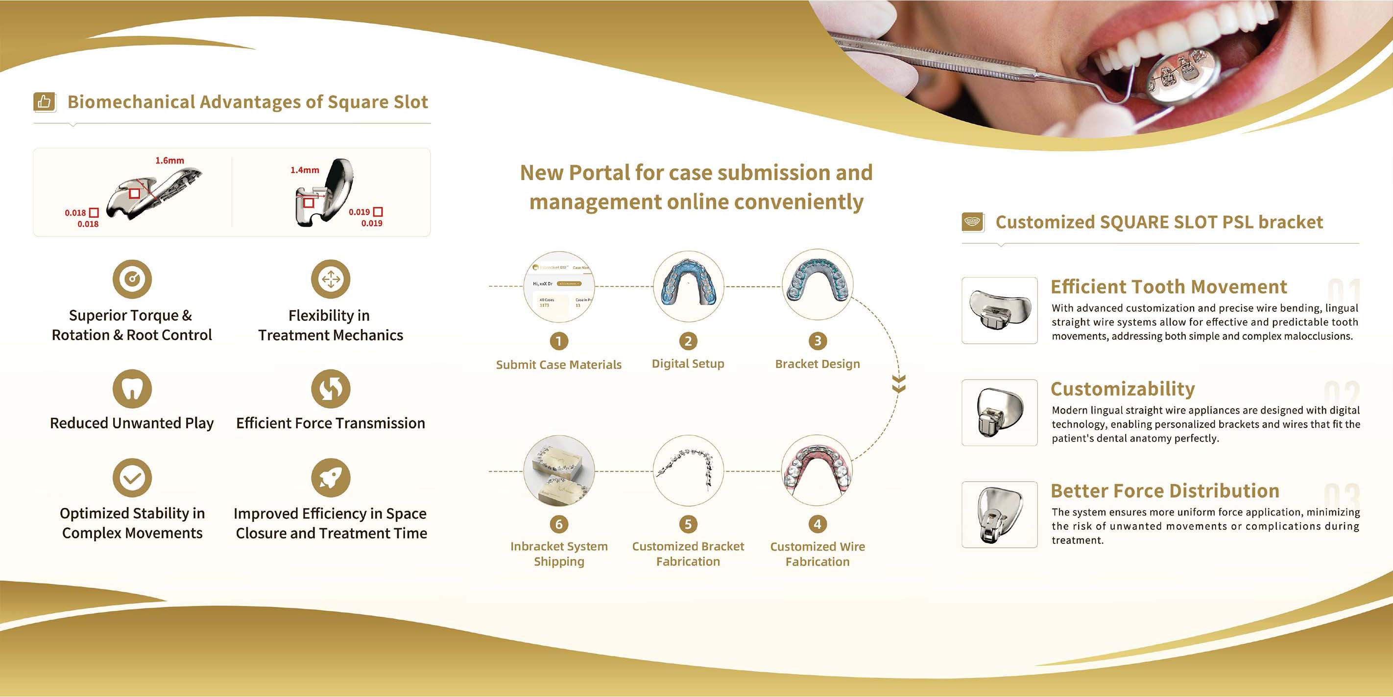InBracket Customized Lingual Bracket System - FN Orthodontics