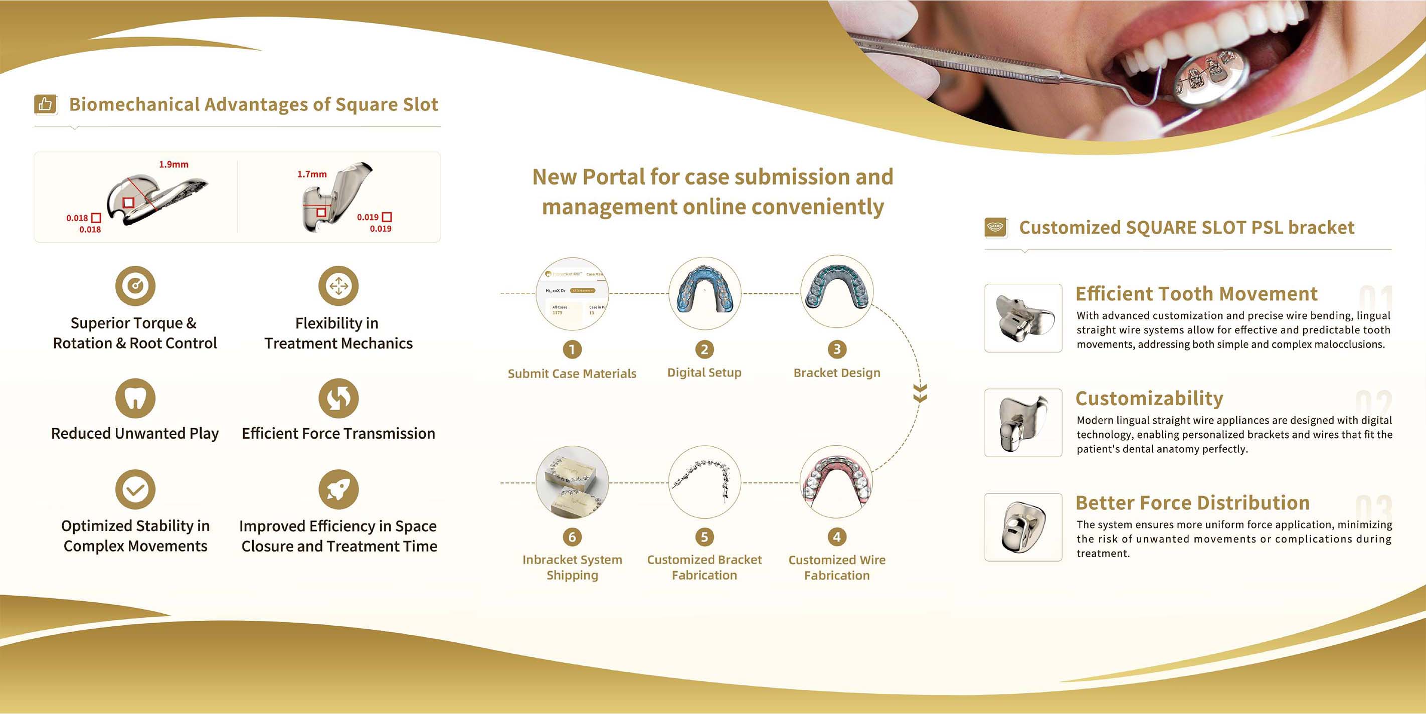 InBracket Customized Lingual Bracket System - FN Orthodontics