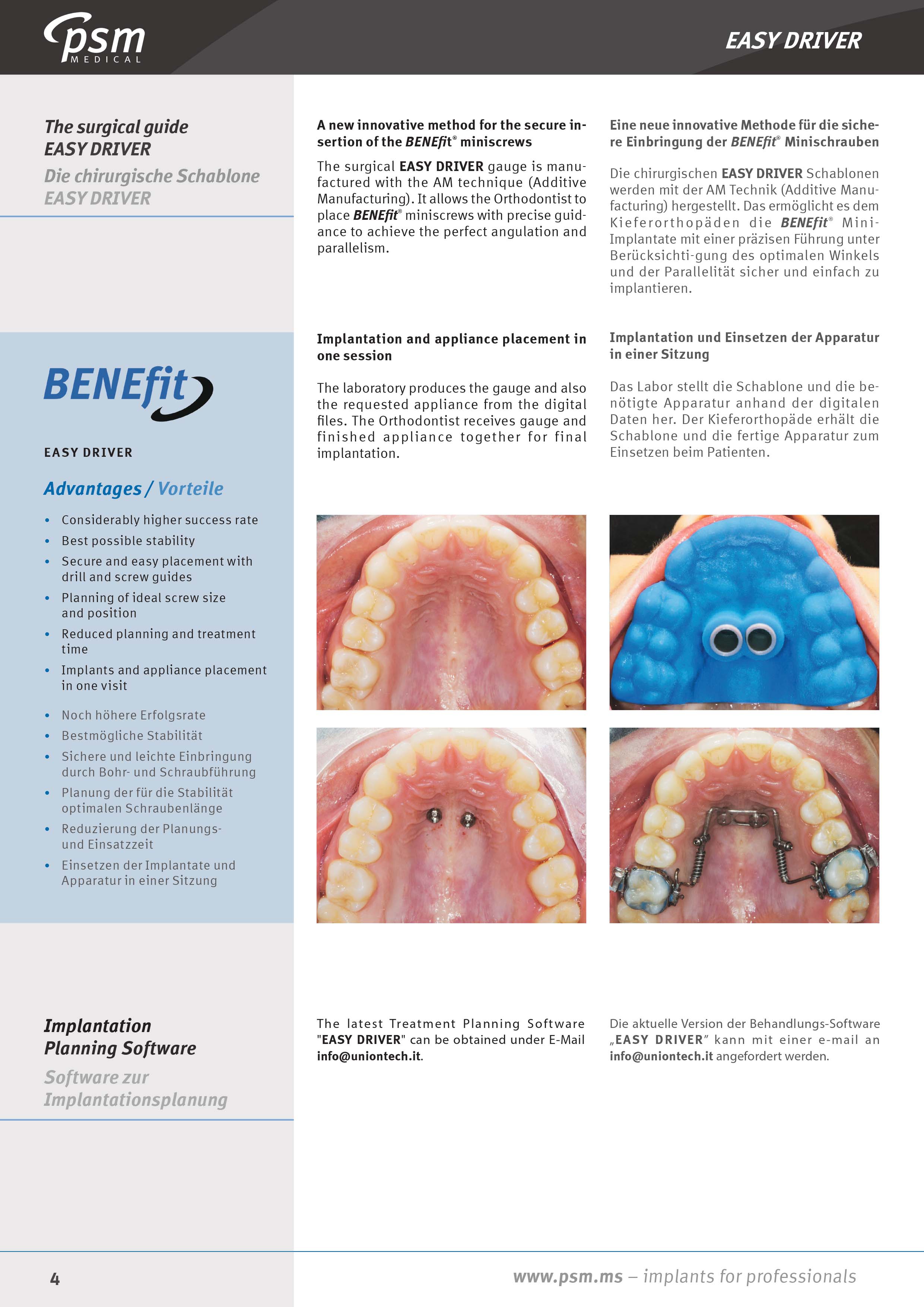 SAPS - Skeletal Anchorage Planning Services - FN Orthodontics
