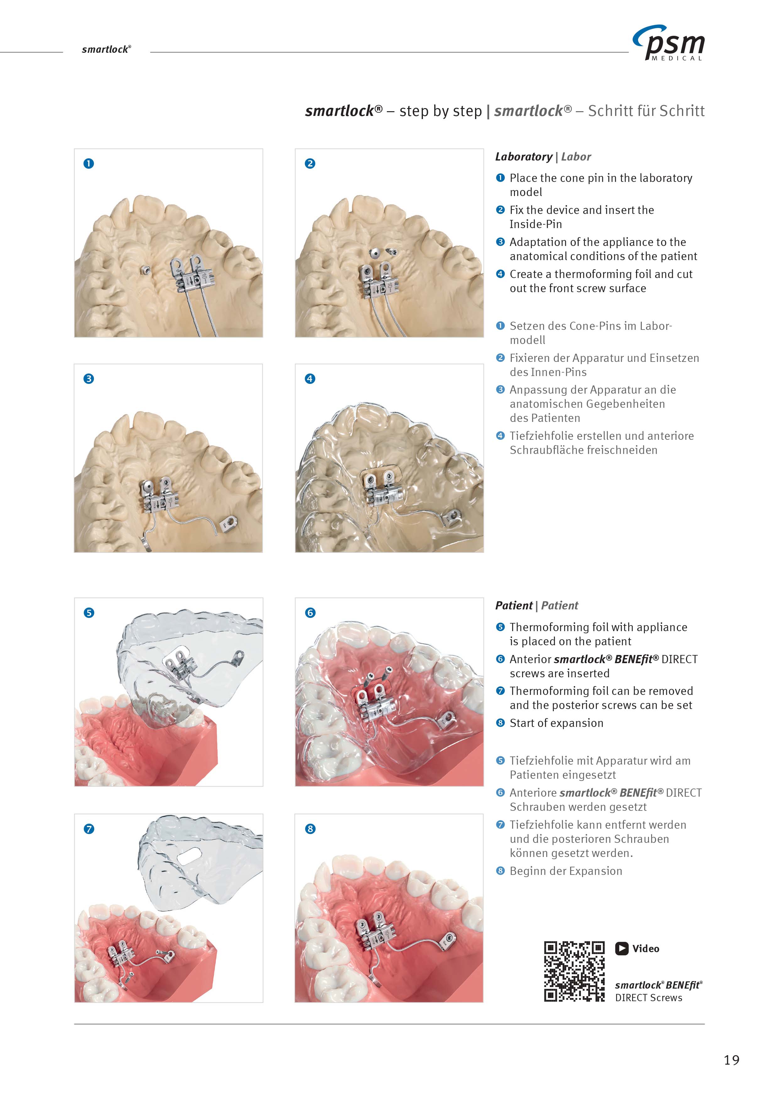 SAPS - Skeletal Anchorage Planning Services - FN Orthodontics