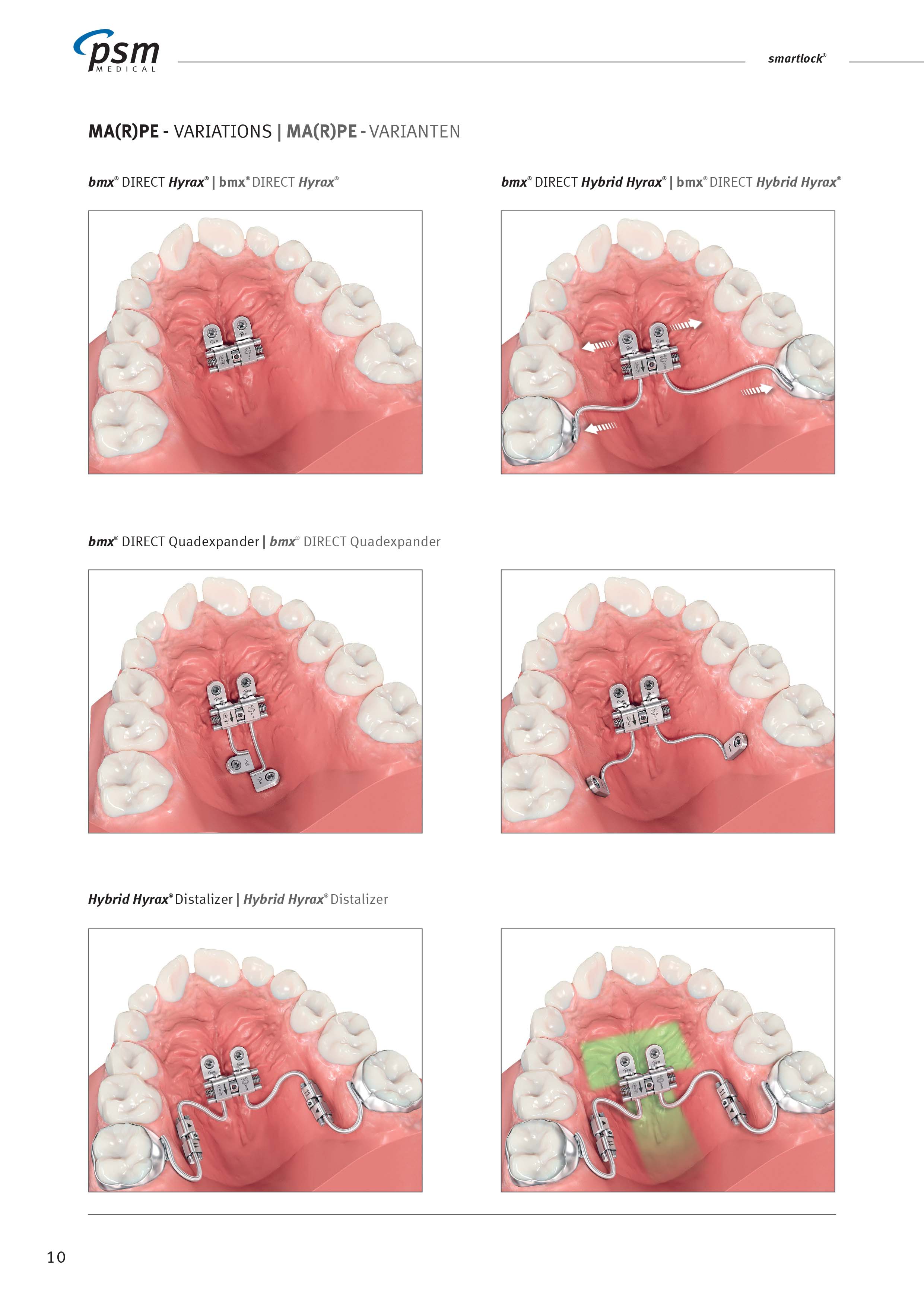 SAPS - Skeletal Anchorage Planning Services - FN Orthodontics