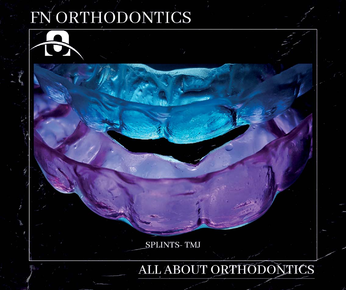 Splints TMJ - Fn Orthodontics